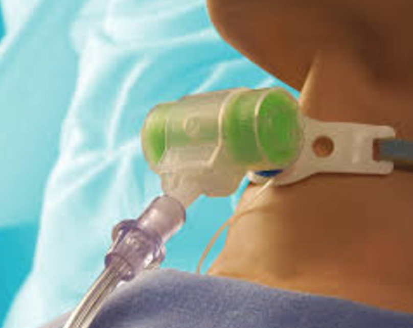 INTERSURGICAL Hydro Trach T HME Filter – Pack of 5